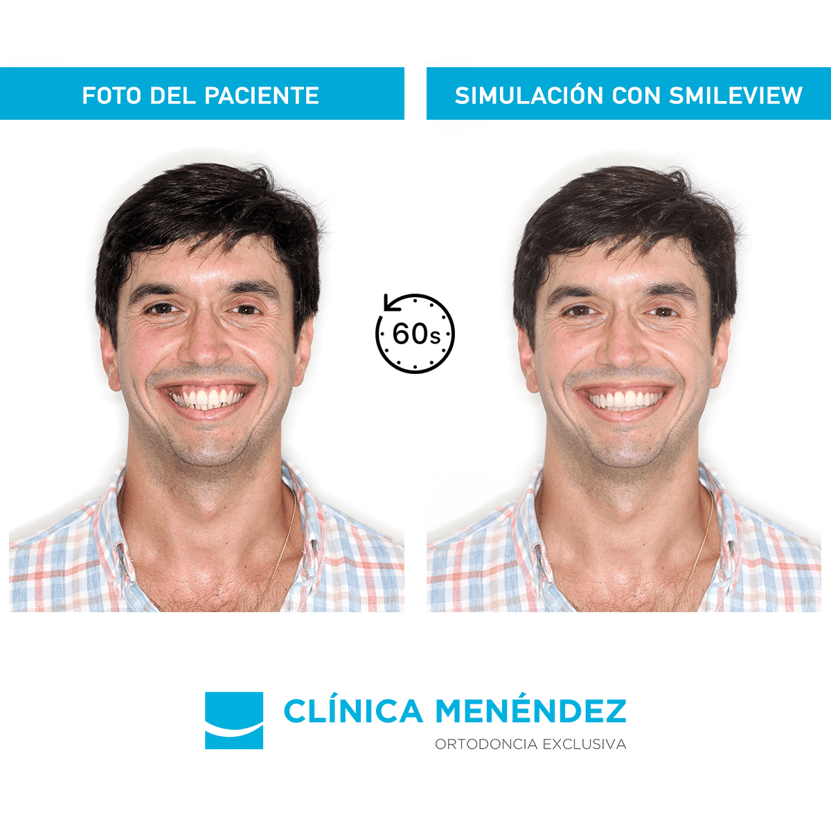 SmileView de Invisalign simula tu sonrisa en 60 segundos SmileView de Invisalign simula tu sonrisa en 60 segundos
