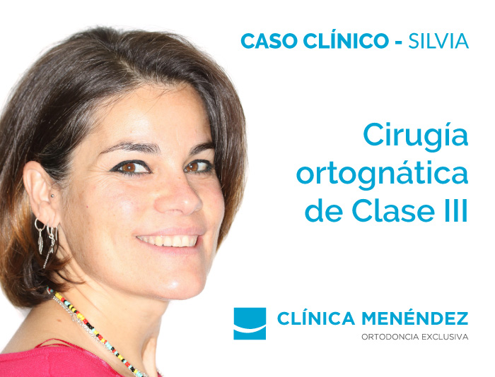 caso clinico cirugia silvia