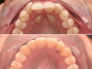 casos ortodoncia complejos granada menendez