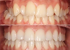 ortodoncia multidisciplinar granada menendez64