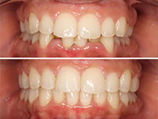 ortodonciamenendez60