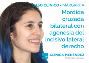 2121 04 05 caso margarita