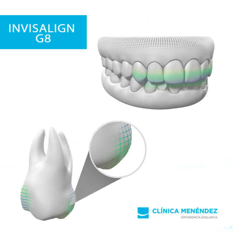 Align Technology anuncia Invisalign G8 con SmartForce