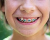 ortodoncia niños