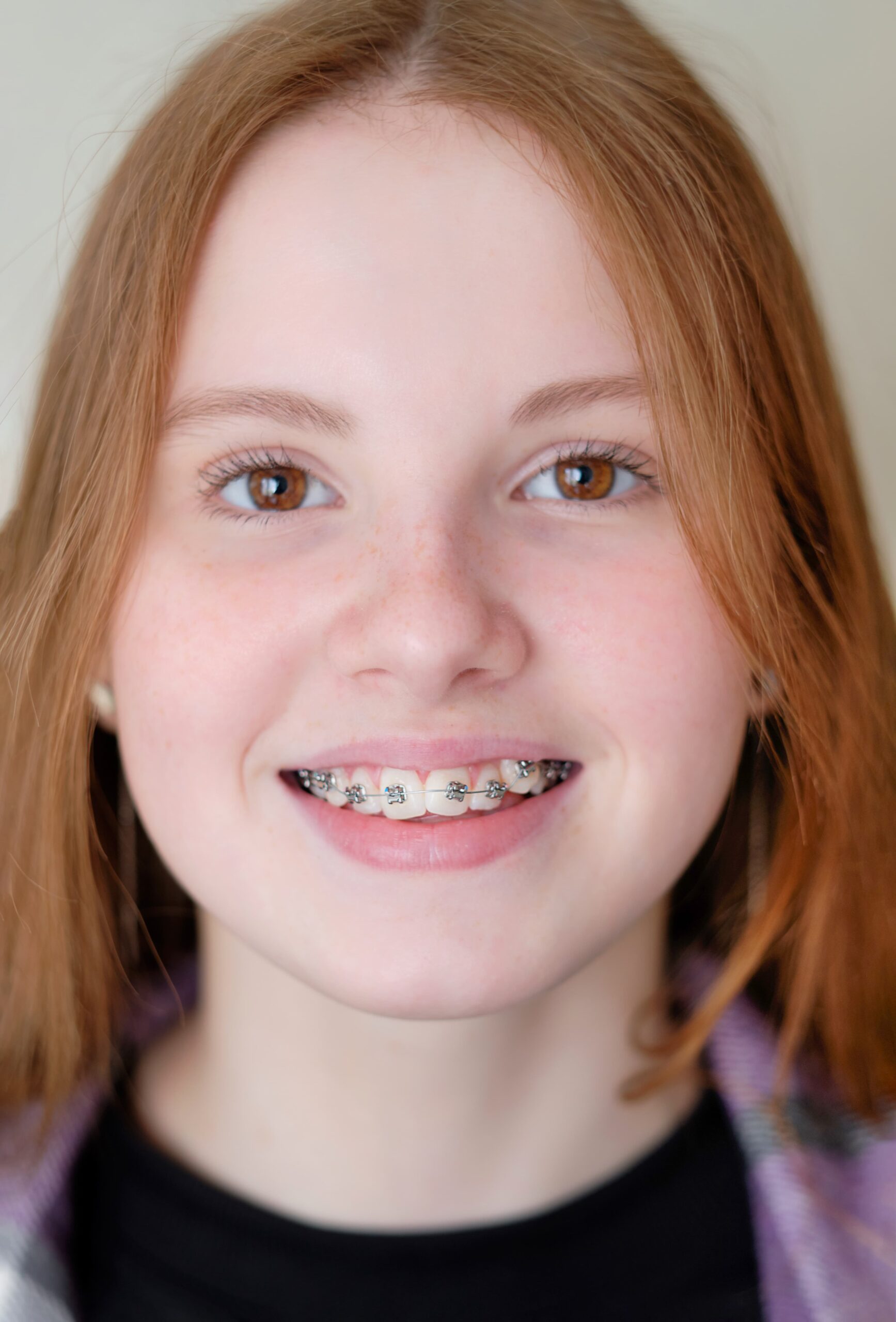 ortodoncia adolescentes