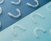 invisalign o spark cual es mejor