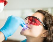 tipos blanqueamiento dental