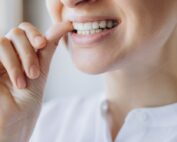 ataches invisalign ortodoncia invisible