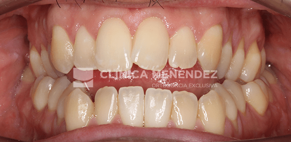 GONZALEZ AGUADO HUGO ANTES (DETALLE) min