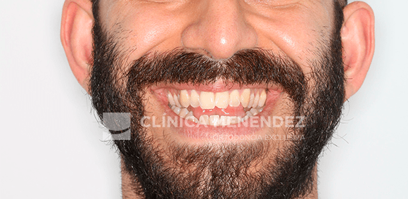 GONZALEZ AGUADO HUGO ANTES min