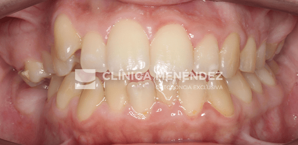 CASTRO MORENO MARIA ANTES (DETALLE) min