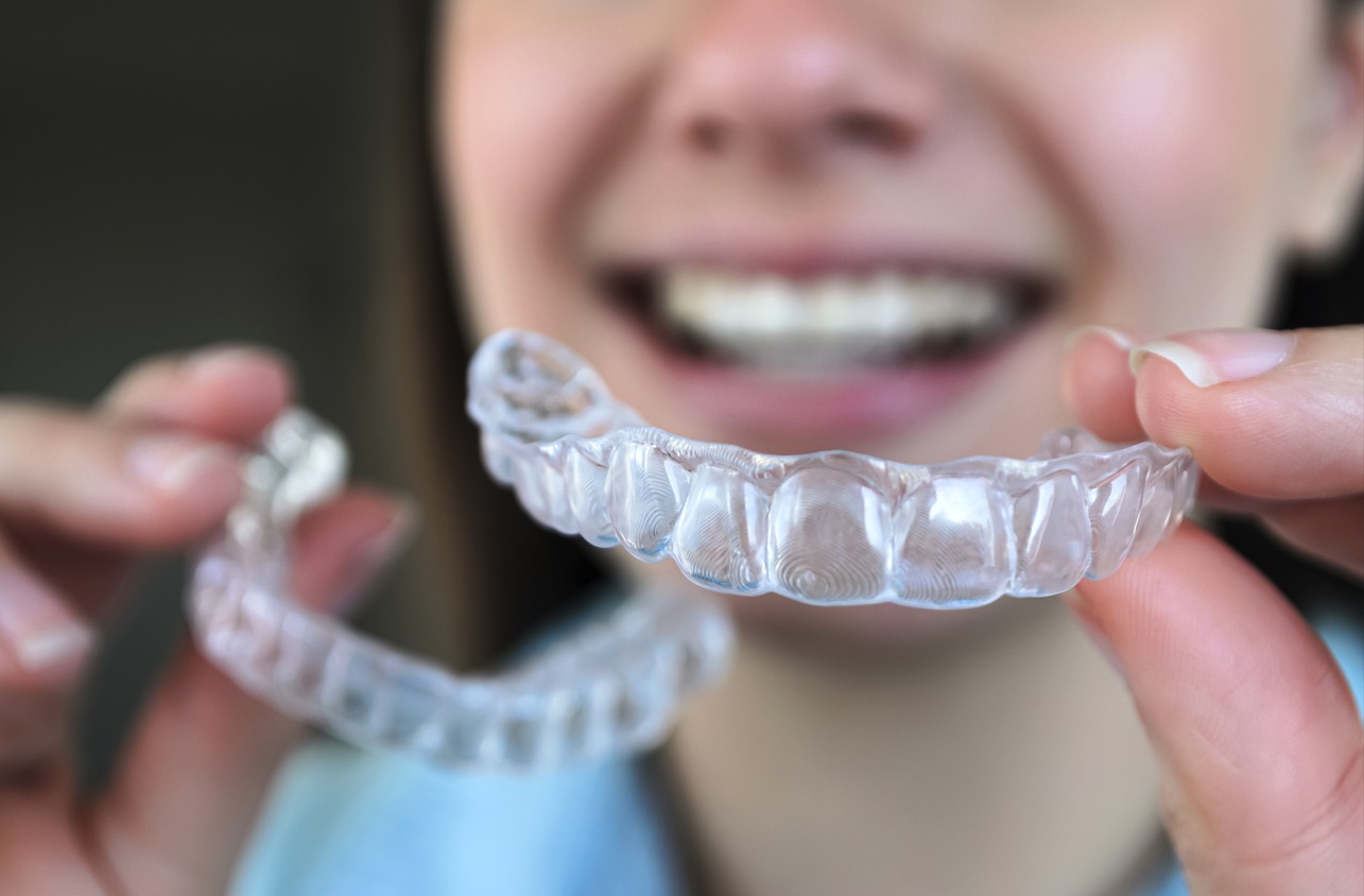 Angel Aligner vs Invisalign: diferencias, ventajas y cuál elegir