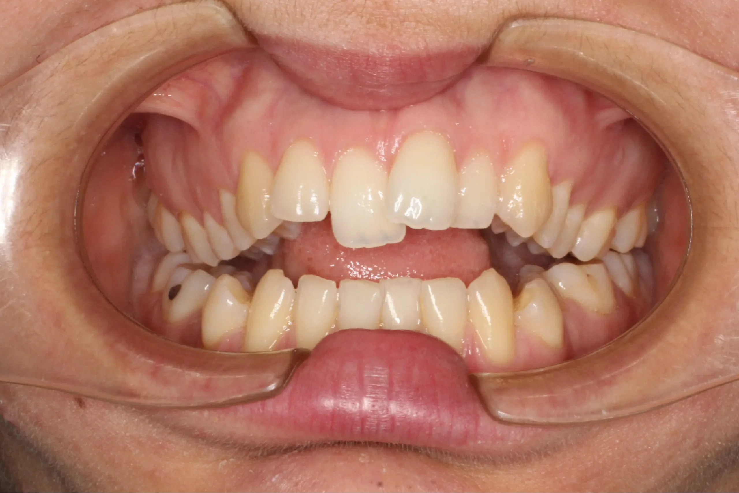 Imagen antes del tratamiento