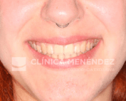 cirugia ortognatica granada