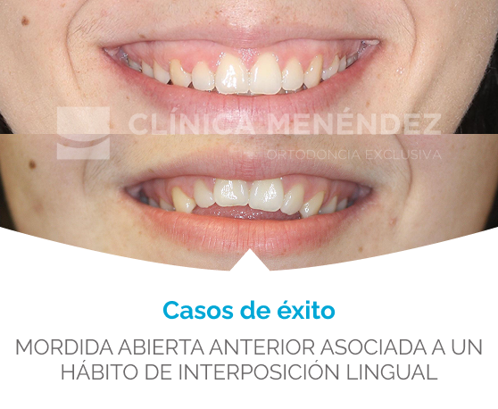 ana